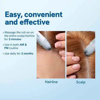 Hair Growth Roll-On Serum – See hair growth in 4 week